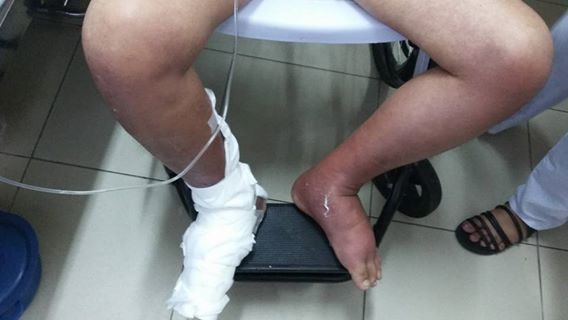 Cầu Thay Cho Em Nguyễn Hữu Tuân Bị Nhiễm Trùng Máu