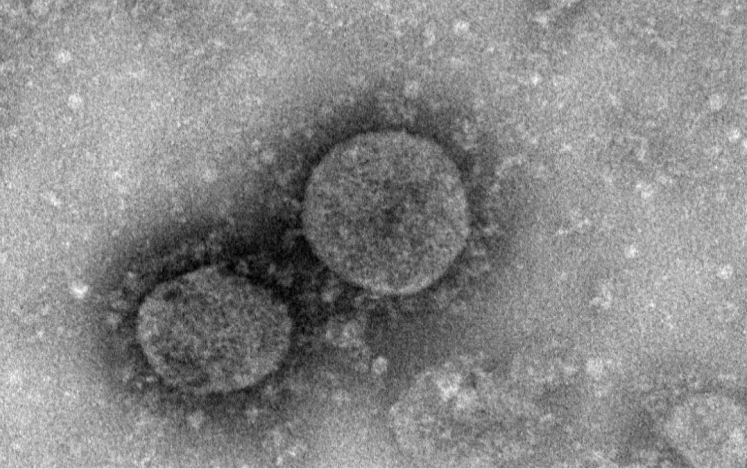 Nhóm Nghiên Cứu Hồng Kông Đã Chế Được Vắc Xin Cho Virus Vũ Hán