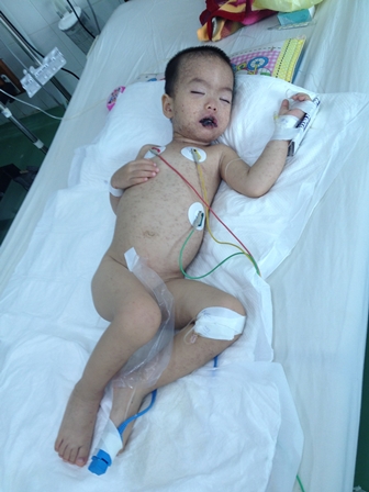 Xin Cầu Nguyện Cho Con Trai TĐ Nguyễn Minh Đức (HT Báp-tít Nam Phương Đà Nẵng) Đang Trong Tình Trạng Nguy Kịch