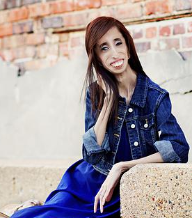 lizzie velasquez, đức tin, ch&uacute;a, jesus